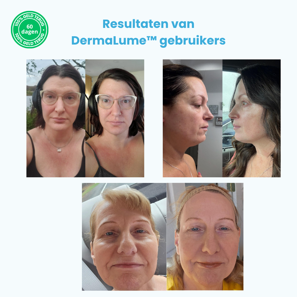 GlowAgePro™ – Non-Surgical Face Lift – 50% Off – Free Shipping