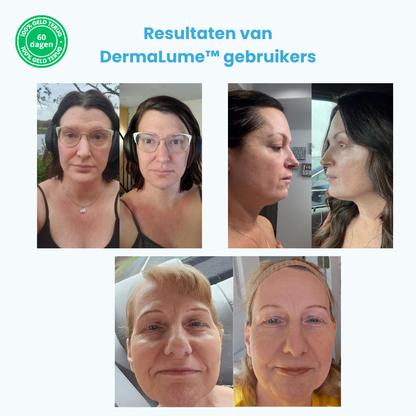 GlowAgePro™ – Non-Surgical Face Lift – 50% Off – Free Shipping