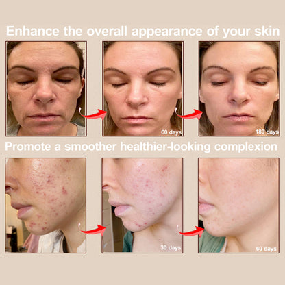 RadiancePro™ Wireless LED Light Therapy Mask – Professional Skin Treatment at Home